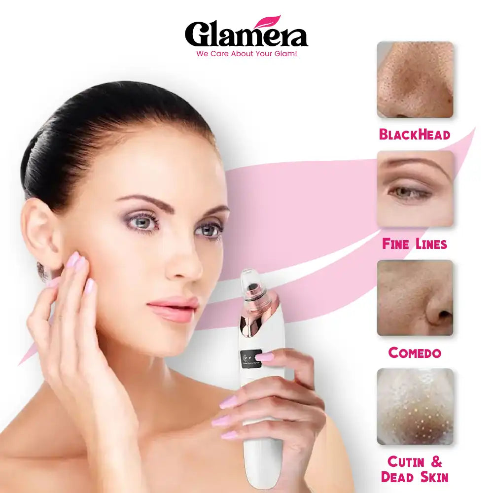 Glamera 5-in-1 Blackhead Remover Vacuum