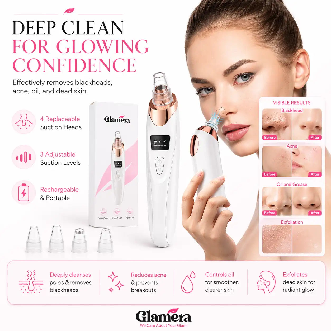 Glamera 5-in-1 Blackhead Remover Vacuum