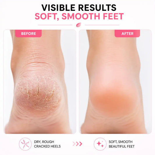 Self-Care Beauty Bundle – Face Massager + Foot Callus Remover
