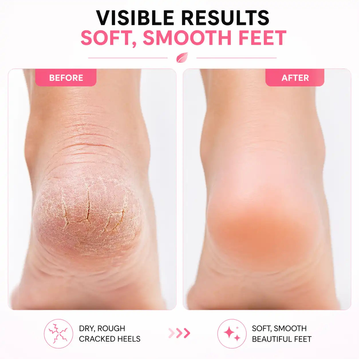 Glamera Electric Foot File Callus Remover